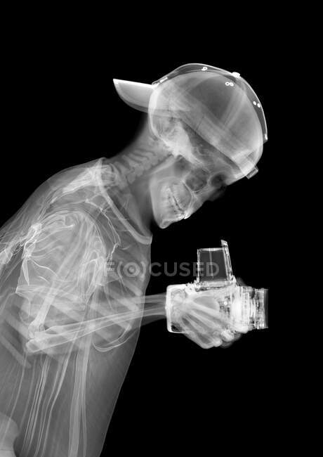 Fotógrafo esqueleto, rayos X. - foto de stock