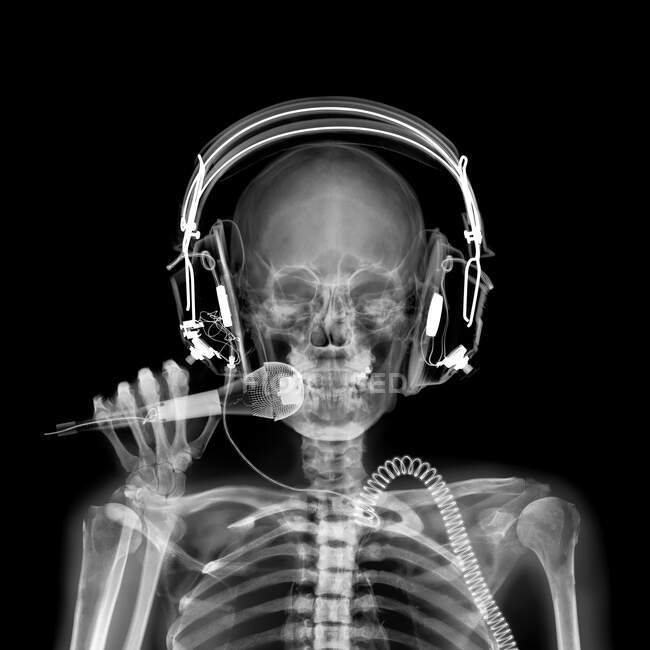 Discjockey, Röntgen, Radiologie — Stockfoto