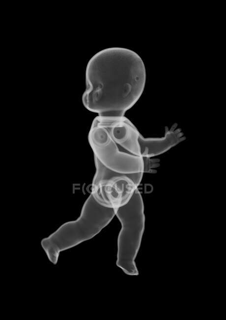 Plastic baby doll toy, X-ray. — Stock Photo