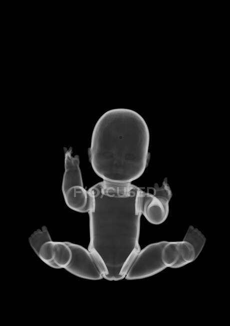 Bambola giocattolo di plastica, raggi X. — Foto stock