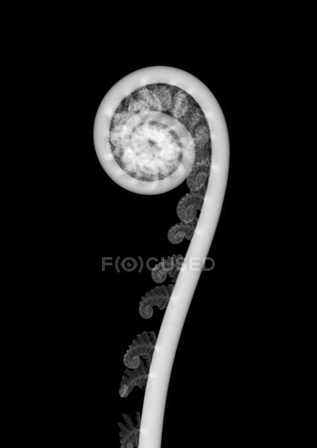 Dicksonia sp ) рентгенівський знімок. — стокове фото