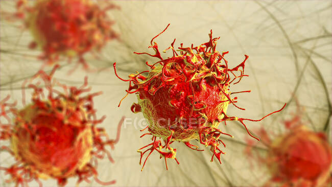 Skin cancer cell, computer illustration. — Stock Photo
