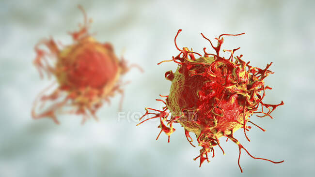 Célula de cáncer de piel, ilustración por computadora. - foto de stock
