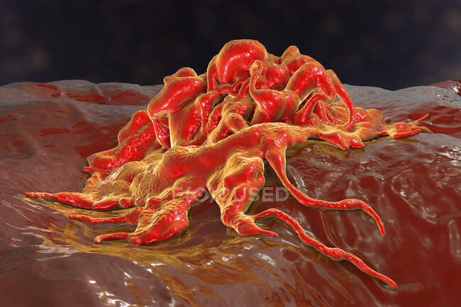 Cancer cell, computer illustration. — Stock Photo
