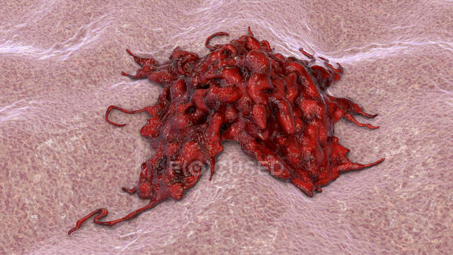 Раковые клетки, компьютерная иллюстрация. — стоковое фото