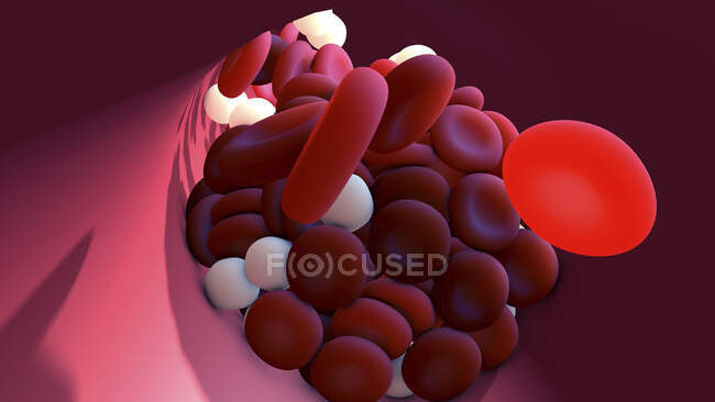 Coágulo de sangre, ilustración por computadora - foto de stock