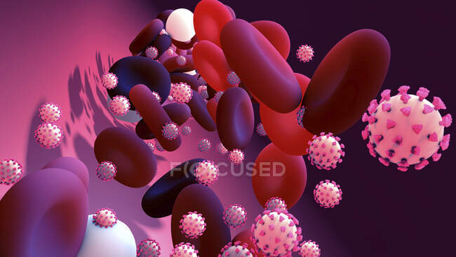 Infección por Coronavirus, ilustración conceptual. - foto de stock