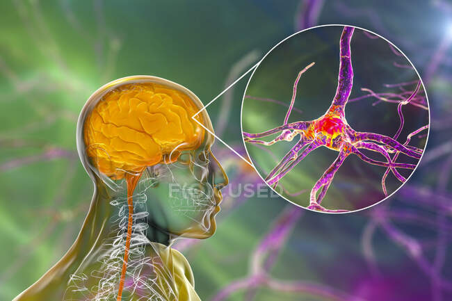 Menschliches Gehirn mit Nahsicht auf Neuronen, Computerillustration. — Stockfoto