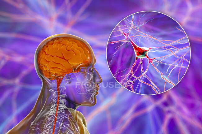 Human brain with close-up view of neurons, computer illustration. — Stock Photo