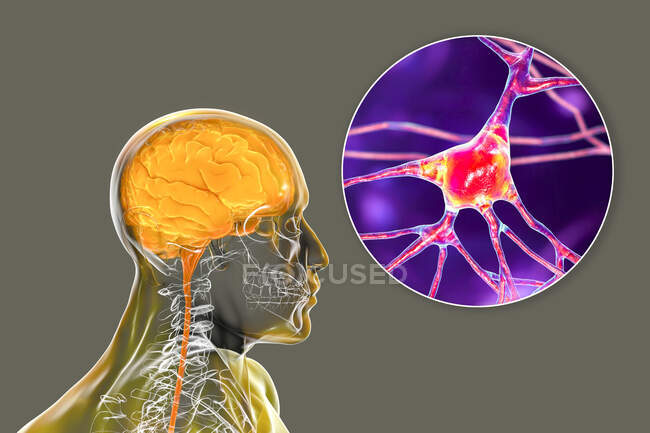 Cerveau humain avec vue rapprochée des neurones, illustration informatique. — Photo de stock