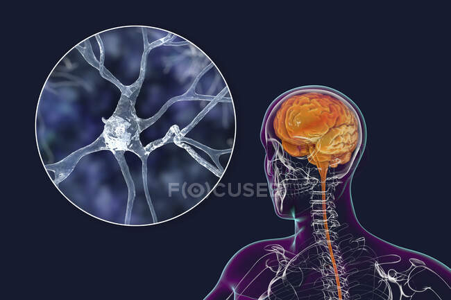 Menschliches Gehirn mit Nahsicht auf Neuronen, Computerillustration. — Stockfoto