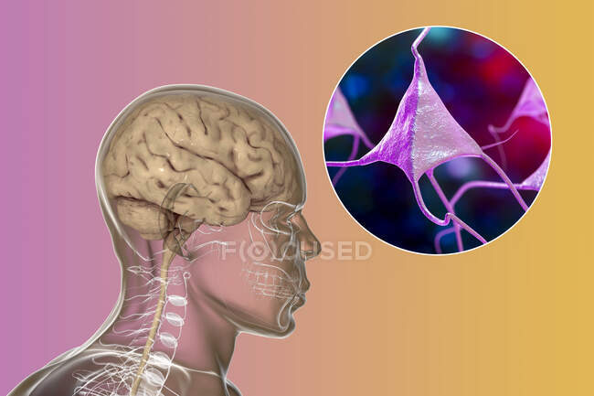Cerveau humain avec vue rapprochée des neurones, illustration informatique. — Photo de stock