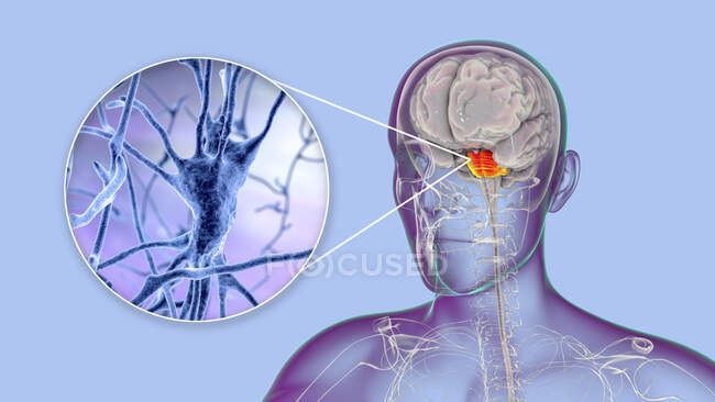 Cerveau humain avec des pons et des neurones surlignés, illustration. Cerveau humain avec des pons surlignés Varolii et vue rapprochée des neurones pyramidaux (cellules nerveuses) situés dans les pons — Photo de stock
