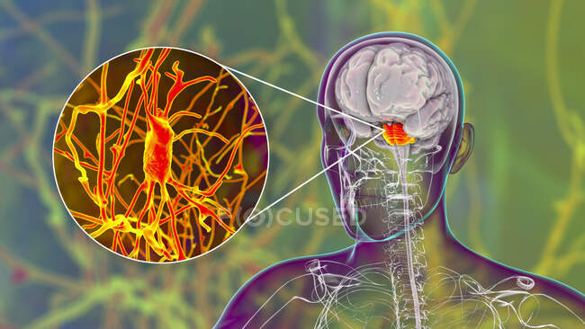 Человеческий мозг с выделенными понами и нейронами, иллюстрация. Мозг человека с выделенными понами Вароли и крупным планом пирамидальных нейронов (нервных клеток), расположенных в понах — стоковое фото