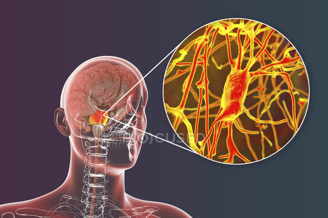 Cerebro humano con puntas y neuronas resaltadas, ilustración. Cerebro humano con puntos destacados Varolii y vista de cerca de las neuronas piramidales (células nerviosas) ubicadas en puntos - foto de stock