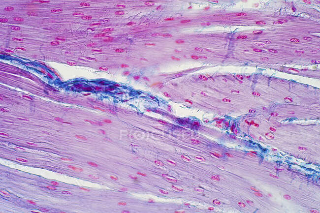 Human smooth muscle, light micrograph. — Stock Photo