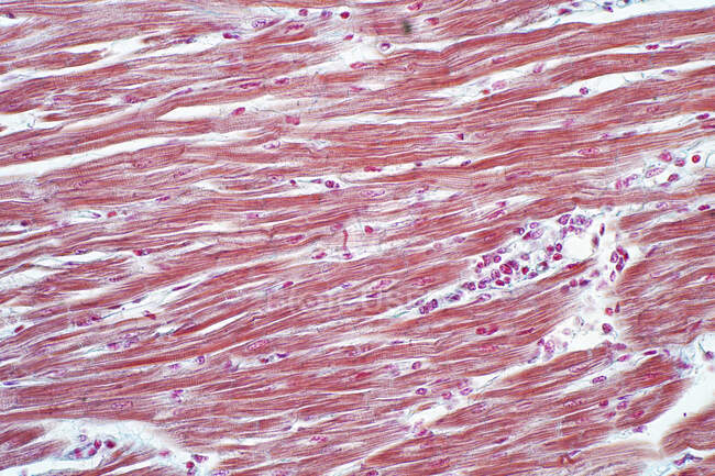 Menschlicher Herzmuskel, leichte Mikrographie. — Stockfoto