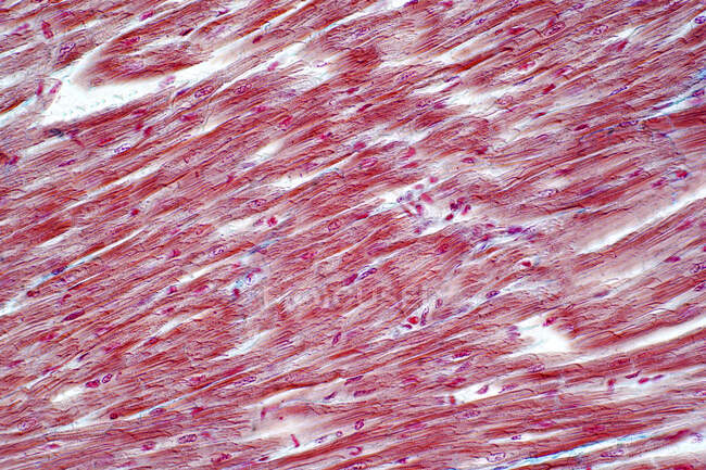 Muscolo cardiaco umano, micrografo leggero. — Foto stock