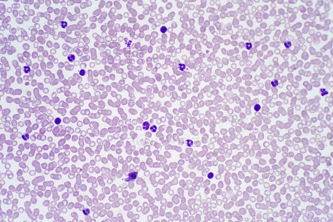 Menschliche Blutzellen, leichte Mikrographie. — Stockfoto