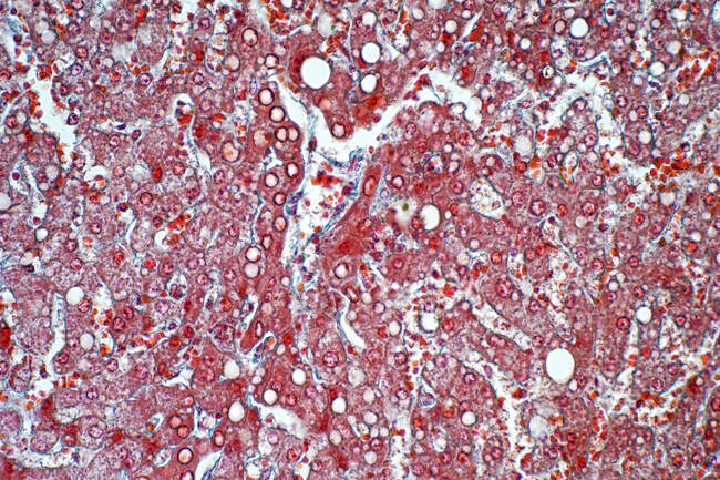 Liver tissue, light micrograph. Animal tissue. — Stock Photo