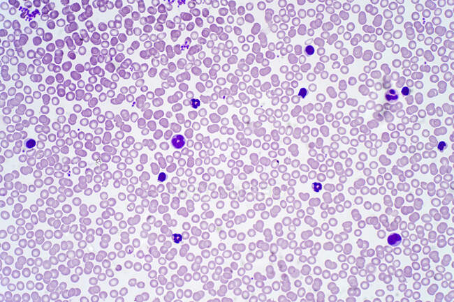 Células sanguíneas humanas, micrografía ligera. - foto de stock