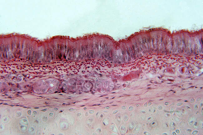Epitelio pseudostratificato, micrografo leggero. L'epitelio pseudostratificato è un tipo di epitelio che comprende un solo strato di cellule. — Foto stock
