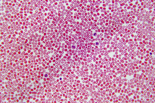 Células sanguíneas, micrografia de luz. — Fotografia de Stock