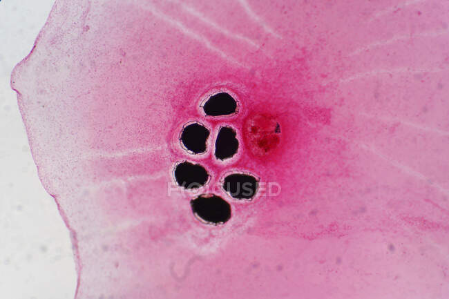 Micrografía ligera de huevos de trepa hepática en una escama de pescado. - foto de stock