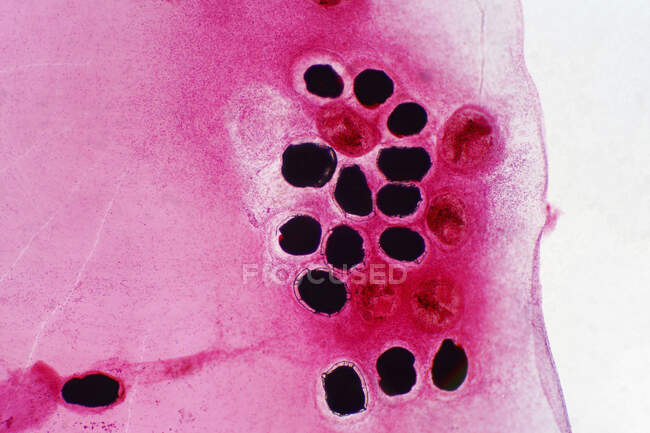 Micrografo leggero di uova di trematode epatiche in scala di pesce. — Foto stock