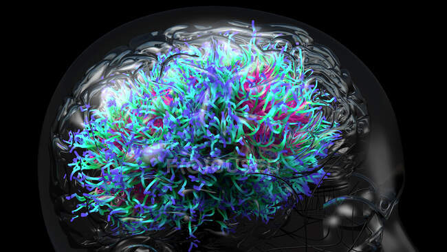 Brain infection, conceptual illustration. — Stock Photo