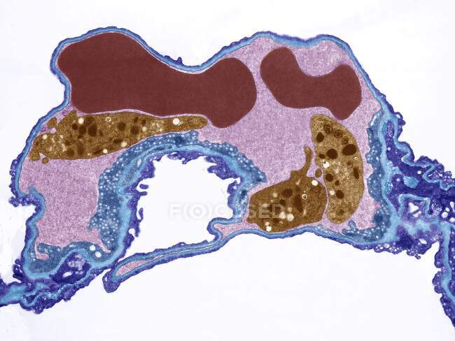 Lung tissue, coloured transmission electron micrograph (TEM). of a pulmonary capillary containing two red blood cells (red) and three platelets (brown). A basement membrane (cyan) surround the endothelium separating it from the alveolar epithelium — Stock Photo