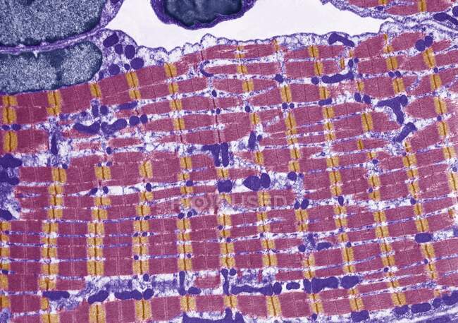 Músculo estriado. Micrografía electrónica de transmisión coloreada (TEM) de una sección longitudinal a través del músculo esquelético estriado. Se observa el patrón de bandas estriadas de las fibrillas musculares - foto de stock