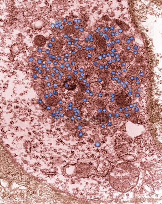 Partículas (azul) do vírus do tumor mamário do ratinho (MMTV), micrografia electrónica de transmissão colorida (MET). MMTV induz tumores malignos nas glândulas mamárias de certas estirpes de camundongos de laboratório — Fotografia de Stock