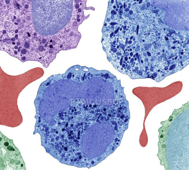 Neutrophile Zellen. Farbige Transmissionselektronenmikroskopie (TEM) menschlicher neutrophiler Zellen. Neutrophile sind an Entzündungsreaktionen auf Gewebeschäden beteiligt, wo sie Mikroorganismen verschlingen und zerstören — Stockfoto