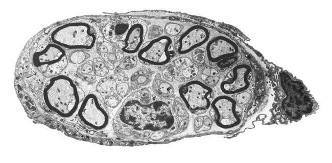 Nervo periférico. Micrografia eletrônica de transmissão em preto e branco (MET) de uma seção através de um pequeno nervo periférico. Mielina (anéis escuros) é uma camada gordurosa isolante que envolve as fibras nervosas mielinizadas — Fotografia de Stock