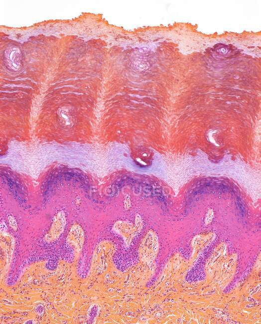 Плантарная кожа, светлый микрограф (ЛМ) с отделенной подошвой кожей стопы. Кожа на подошвах ног называется плантарной кожей, так как внешний слой кератина (стратум роговицы) (сверху) намного толще, чем в остальной части тела. — стоковое фото