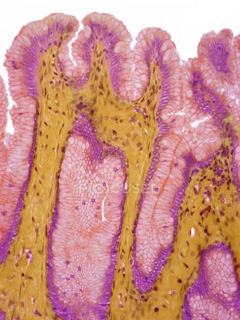 Magenoberflächenepithel, leichte Mikrographie (LM). Das Oberflächenepithel des Magens ist ein einfaches säulenförmiges Epithel, das von hohen Schleimzellen gebildet wird, die in die Magengruben eindringen. — Stockfoto