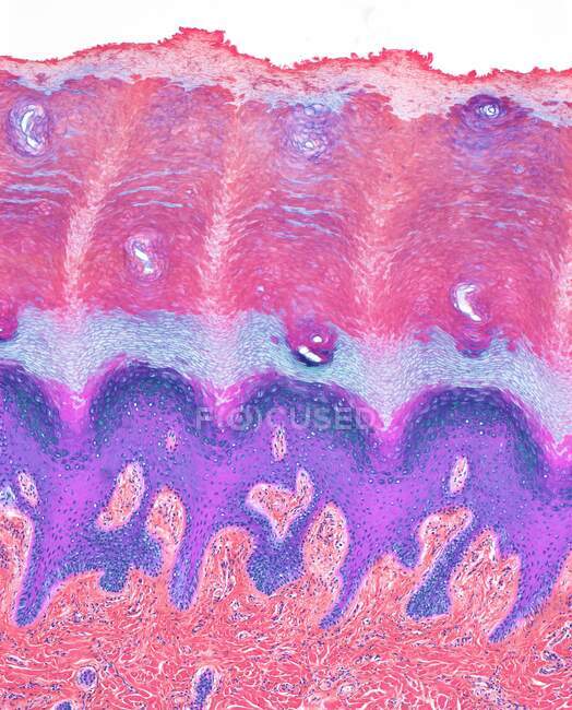 Plantar skin, light micrograph (LM) of sectioned foot sole skin. The skin on the soles of the feet is referred to as plantar skin as the outer layer of keratin (stratum corneum) (top) is much thicker here than in the rest of the body — Stock Photo