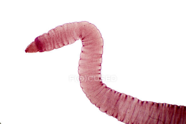 Tapeworm di bovini e di altri animali al pascolo, micrografo leggero. — Foto stock
