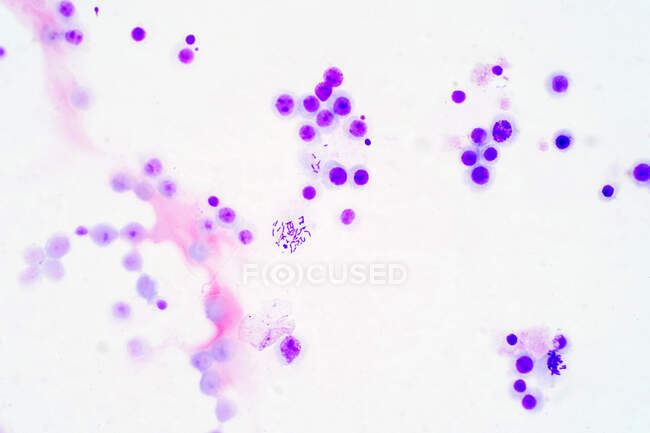 Human chromosomes, light micrograph. — Stock Photo