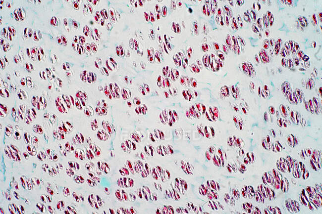 Sezione trasversale della cartilagine umana e dell'osso, micrografo leggero. — Foto stock