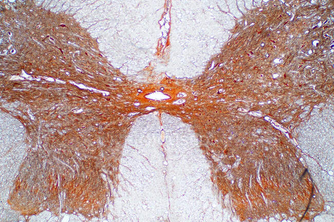 Sezione trasversale del midollo spinale, micrografo leggero. — Foto stock