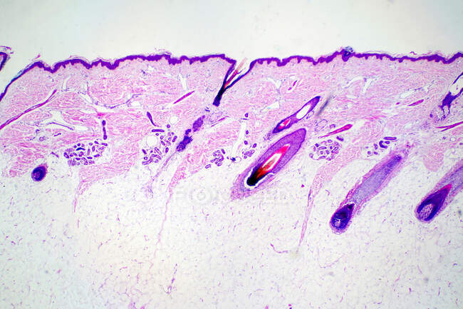 Sezione trasversale del tessuto capelluto umano, micrografo leggero. — Foto stock