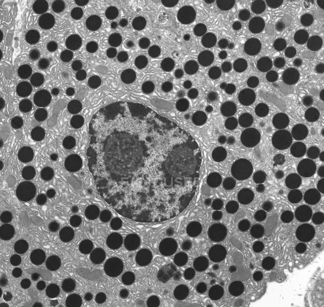 Du tissu de pancréas. Micrographie électronique à transmission (TEM) d'une partie du pancréas exocrine. On voit ici des granules de zymogène et des noyaux cellulaires. Dans l'image, le réticulum endoplasmique qui remplit le cytoplasme est clairement visible.. — Photo de stock
