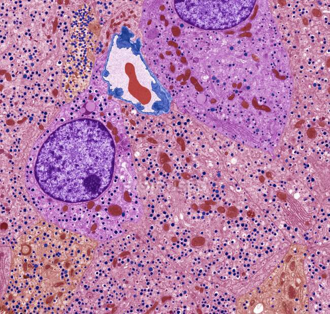 Células de islotes pancreáticos. Micrografía electrónica de transmisión coloreada (TEM) de una sección a través del tejido pancreático, mostrando células conocidas como Isletas de Langerhans. Estas células ocurren en distintos grupos ovoides que suman alrededor de 1 millón en humanos. - foto de stock