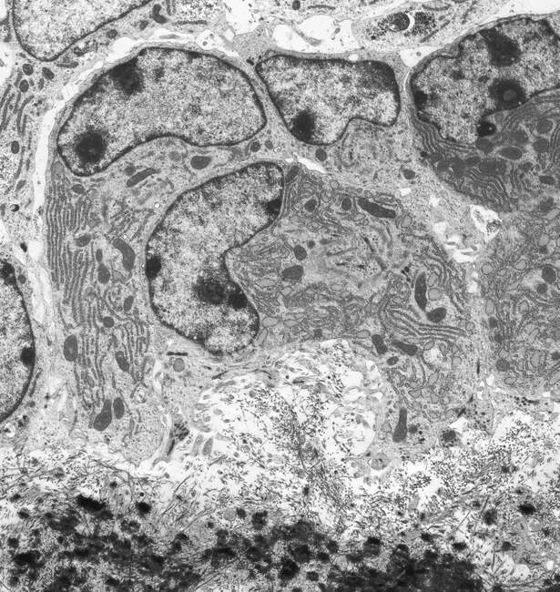 Osteoblastos. Micrografía electrónica de transmisión coloreada (TEM) de osteoblastos, células productoras de hueso (púrpura y rosa). Contienen retículo endoplásmico rugoso (RER), que produce, modifica y transporta proteínas, y núcleo - foto de stock