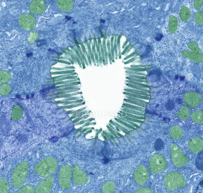 Microvellosidades intestinales. Micrografía electrónica de transmisión coloreada (TEM) de una sección a través de microvellosidades del intestino delgado. Estas diminutas estructuras (cian) forman un denso recubrimiento similar a un cepillo en las superficies absorbentes de las células. - foto de stock