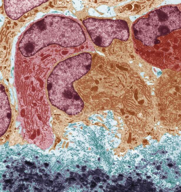 Остеобласти. Кольоровий трансмісійний електронний мікрограф остеобластів, кістково-виробничі клітини (фіолетовий і рожевий). Вони містять грубий ендоплазматичний ретикулум (RER), який виробляє, змінює і транспортує білки, і ядро — стокове фото