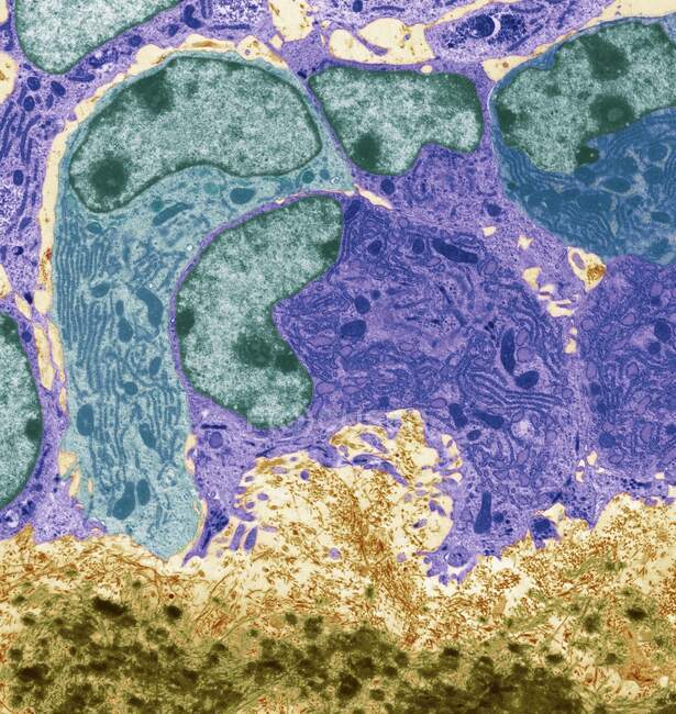 Osteoblastos. Micrografía electrónica de transmisión coloreada (TEM) de osteoblastos, células productoras de hueso (púrpura y rosa). Contienen retículo endoplásmico rugoso (RER), que produce, modifica y transporta proteínas, y núcleo - foto de stock