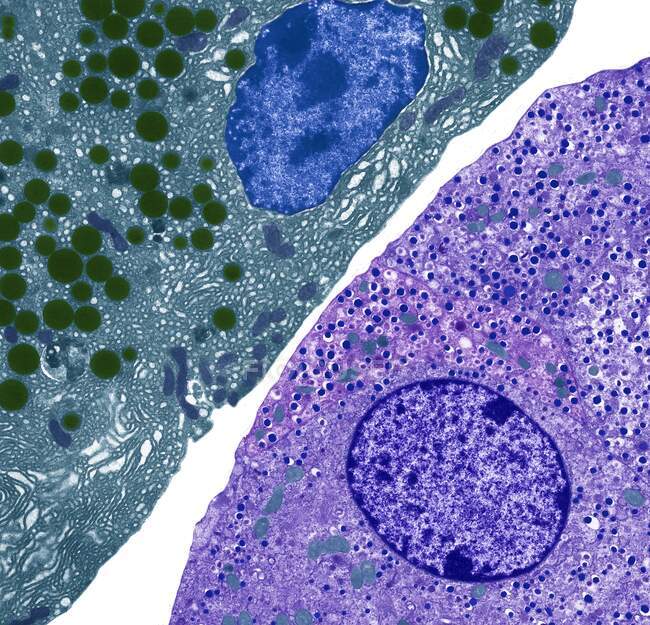 Cellules pancréatiques. Micrographie électronique à transmission colorée (TEM) des cellules acinaires (exocrines) pancréatiques (rouges) adjacentes aux cellules de l'îlot de Langerhans sécrétant des hormones (endocrines) (jaune) — Photo de stock